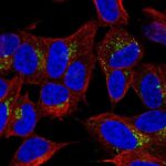 Canlılarda iştahı kontrol eden nöropeptid Y reseptörleri