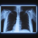 X ışını Oluşumu, özellikleri ve kullanım alanları