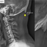 telefon kullanımı boynuz