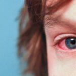 kedi alerjisi aşısı