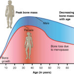 615 Age and Bone Mass