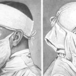 Maske kullanımının tarihi 17. yüzyıldan günümüze