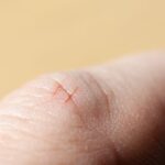 Kağıt kesiği neden çok acıtıyor?