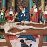 Bir kadavranın diseksiyonu, 15. yüzyıl tablosu.