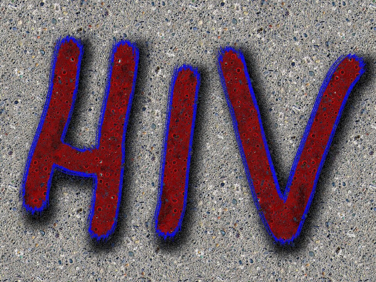 hiv aids