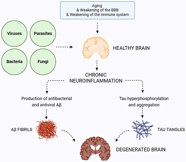 Burun Karıştırmak Alzheimer Riskini Nasıl Artırabilir? 2 Alzheimer