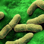 Yersinia pestis kara veba