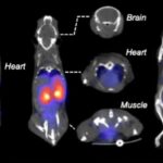 radyoaktif meyve şekeri