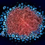 Kok Hucre Naklinden Sonra Yedinci Kisi HIVden Kurtuldu