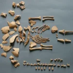 Tunç ve Demir Çağlarındaki Down Sendromu Vakaları