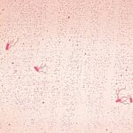 Alcaligenes faecalis