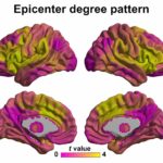 Beyindeki aktiviteyi saptamak için merkez üssü haritalama