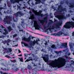 Yeni biyoaktif malzemenin mikroyapısı. Lifler pembe renkte; hyaluronik asit mor renkte gösterilmiştir