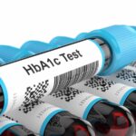 HbA1c test