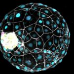 Uyuyan bir insan blastoidi